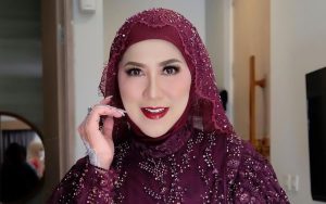 Foto Venna Melinda Diduga Alami KDRT Hingga Hidung Berdarah Beredar di Medsos